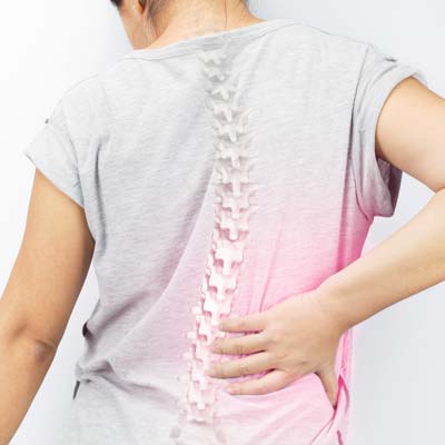 What Can I Do About Scoliosis? Chiropractic Care as a Non-Invasive Treatment